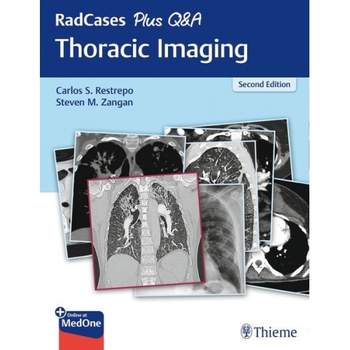 RadCases Plus Q&A Thoracic Imaging