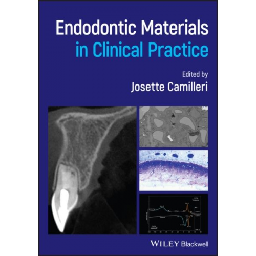 Josette Camilleri - Endodontic Materials in Clinical Practice