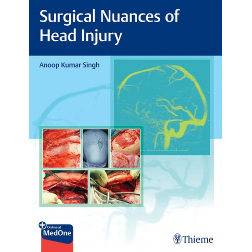 Anoop Kumar Singh - Surgical Nuances of Head Injury