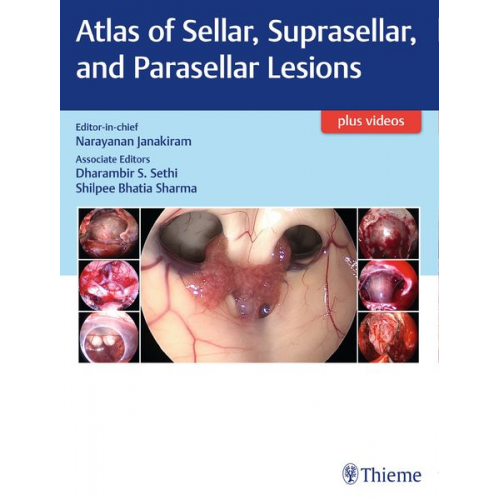 Atlas of Sellar, Suprasellar, and Parasellar Lesions