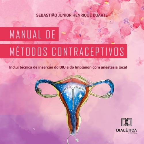 Sebastião Junior Henrique Duarte - Manual de métodos contraceptivos