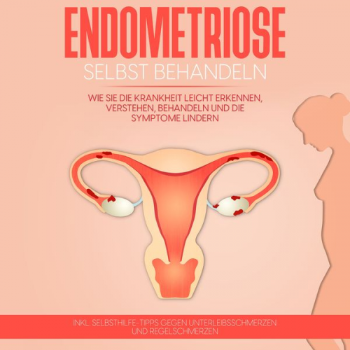 Anita Engelhardt - Endometriose selbst behandeln: Wie Sie die Krankheit leicht erkennen, verstehen, behandeln und die Symptome lindern - inkl. Selbsthilfe-Tipps gegen Un