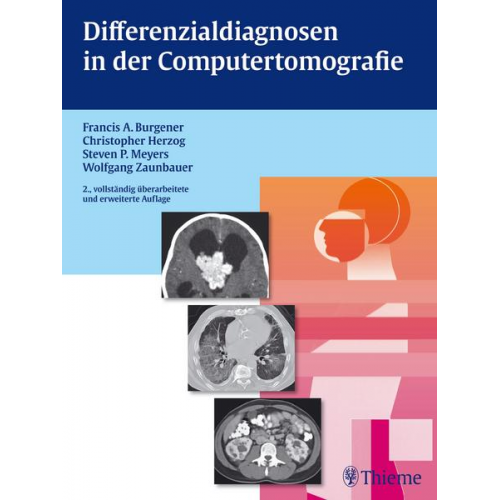 Francis A. Burgener & Christopher Herzog & Steven Meyers & Wolfgang Zaunbauer - Differenzialdiagnosen in der Computertomografie