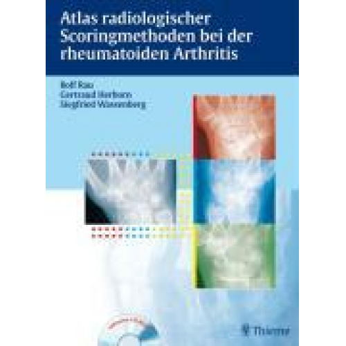 Rolf Rau & Gertraud Herborn & Siegfried Wassenberg - Herborn, G: Atlas radiologischer Scoringmethoden
