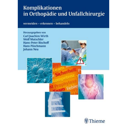 Hans-Peter Bischoff & Wolf-Eberhard Mutschler & Carl Joachim Wirth - Komplikationen in Orthopädie und Unfallchirurgie