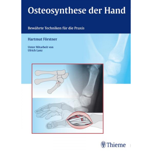 Hartmut Förstner - Osteosynthese der Hand
