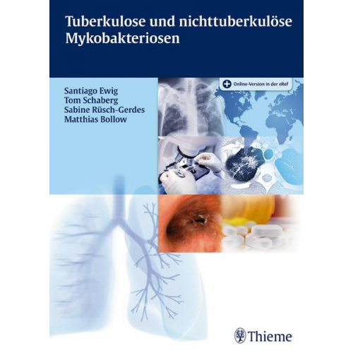 Santiago Ewig & Tom Schaberg & Sabine Rüsch-Gerdes & Matthias Bollow - Tuberkulose und nicht tuberkulöse Mykobakteriosen
