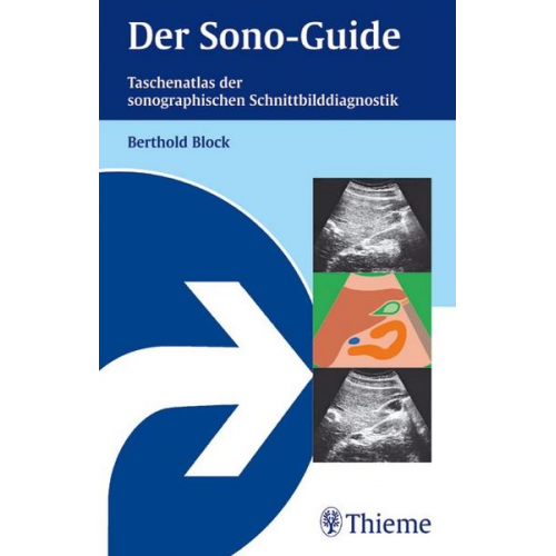 Berthold Block - Der Sono-Guide