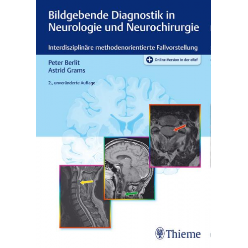 Peter-Dirk Berlit & Astrid E. Grams - Bildgebende Diagnostik in Neurologie und Neurochirurgie