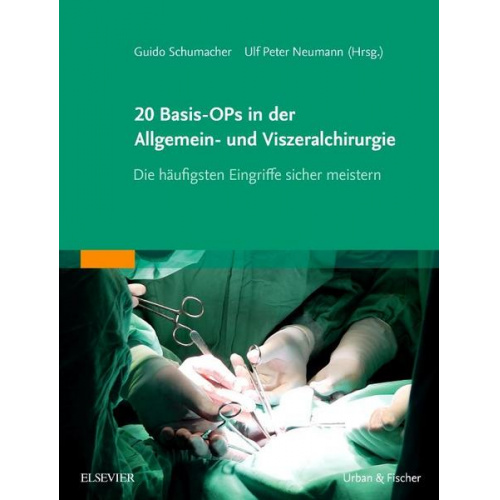 20 Basis-OPs in der Allgemein- und Viszeralchirurgie