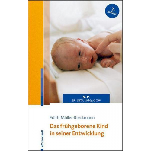 Edith Müller-Rieckmann - Das frühgeborene Kind in seiner Entwicklung