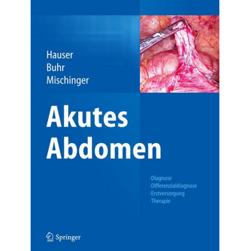 Akutes Abdomen