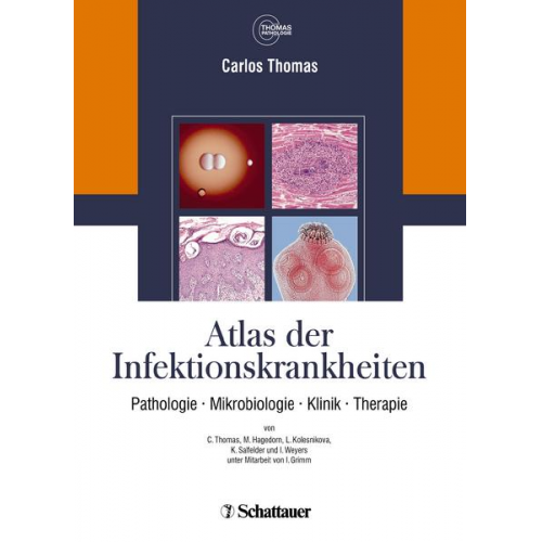 Carlos Thomas & Annette Cecetka-Thomas & Renate Woicichowski - Atlas der Infektionskrankheiten