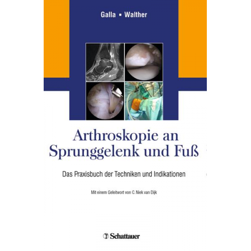 Arthroskopie an Sprunggelenk und Fuß