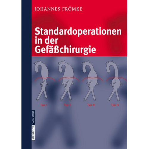 Johannes Frömke - Standardoperationen in der Gefäßchirurgie