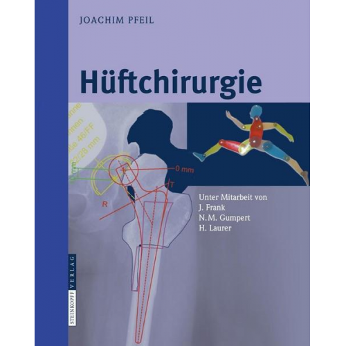 Joachim Pfeil - Hüftchirurgie