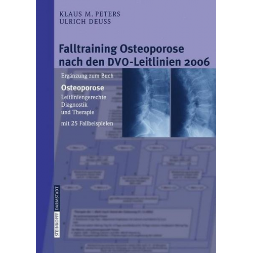 Klaus M. Peters & Ulrich Deuss - Falltraining Osteoporose nach den DVO-Leitlinien 2006