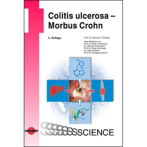 Eduard F. Stange - Colitis ulcerosa - Morbus Crohn