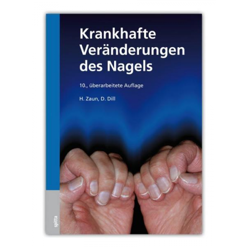 Hansotto Zaun & Dorothee Dill - Krankhafte Veränderungen des Nagels