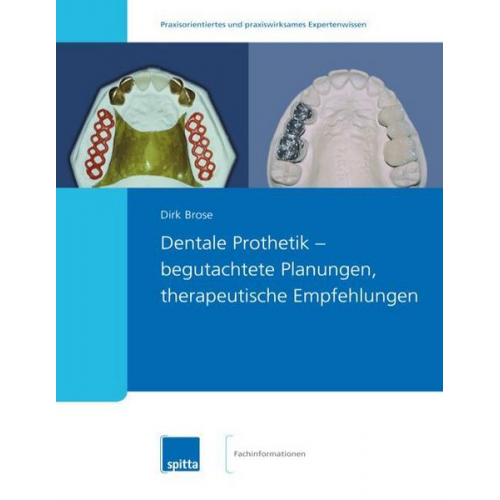 Dirk Brose - Dentale Prothetik – begutachtete Planungen, therapeutische Empfehlungen