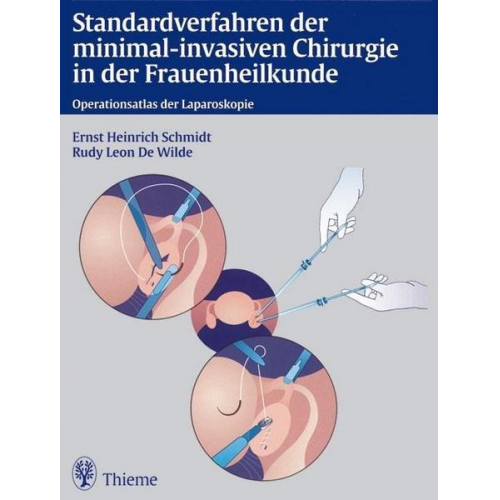 Ernst Heinrich Schmidt & Rudy Leon de Wilde - Standardverfahren der minimal-invasiven Chirurgie in der Frauenheilkunde