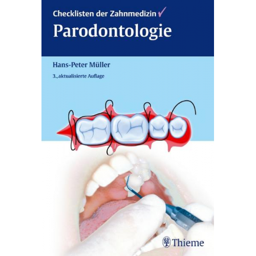 Hans-Peter Müller - Checklisten der Zahnmedizin Parodontologie