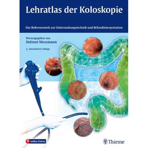 Helmut Messmann - Lehratlas der Koloskopie