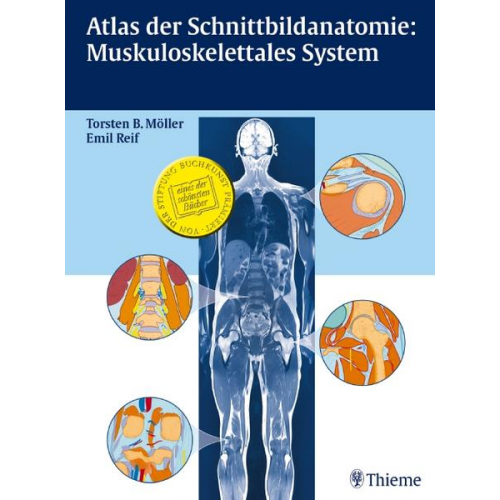 Torsten Bert Möller & Emil Reif - Atlas der Schnittbildanatomie: Muskuloskelettales System