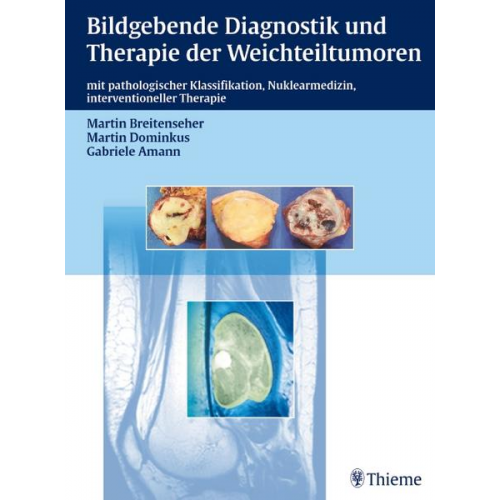 Martin Breitenseher & Martin Dominikus & Gabriele Amann - Bildgebende Diagnostik und Therapie der Weichteiltumoren