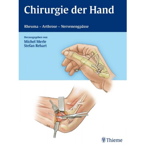 Michel Merle - Chirurgie der Hand