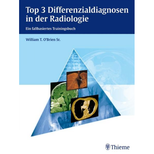 William T. O'Brien - Top 3 Differenzialdiagnosen in der Radiologie