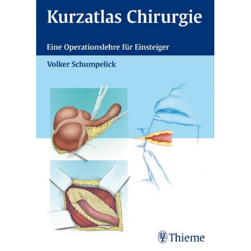 Volker Schumpelick - Kurzatlas Chirurgie