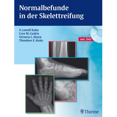 S. Lowell Kahn & Cree M. Gaskin & Victoria L. Sharp & Theodore E. Keats - Normalbefunde in der Skelettreifung