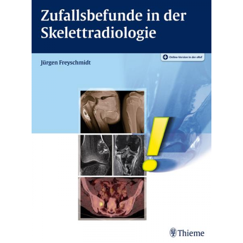 Jürgen Freyschmidt - Zufallsbefunde in der Skelettradiologie