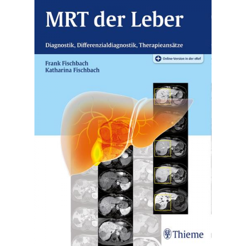 MRT der Leber