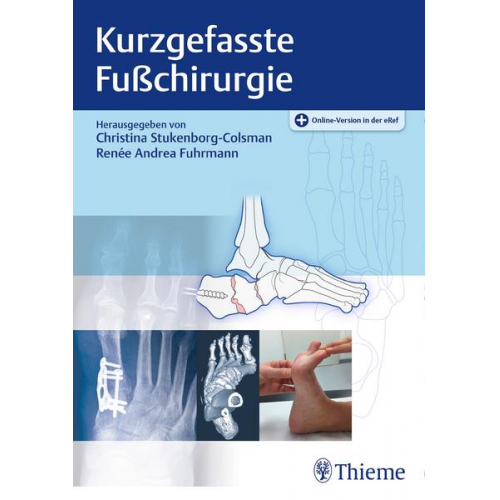 Kurzgefasste Fußchirurgie