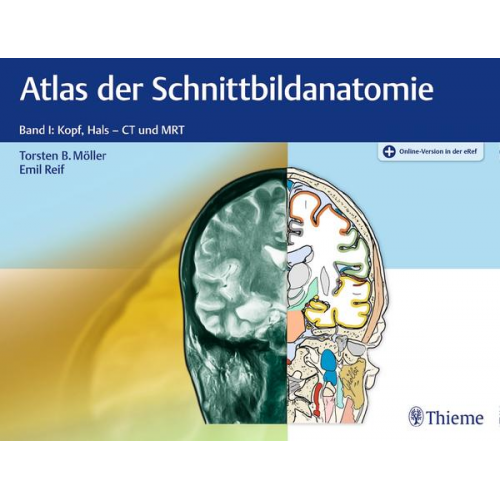 Torsten Bert Möller & Emil Reif - Atlas der Schnittbildanatomie