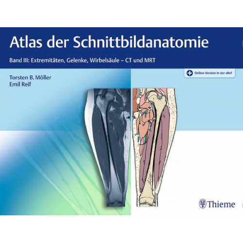 Torsten Bert Möller & Emil Reif - Atlas der Schnittbildanatomie