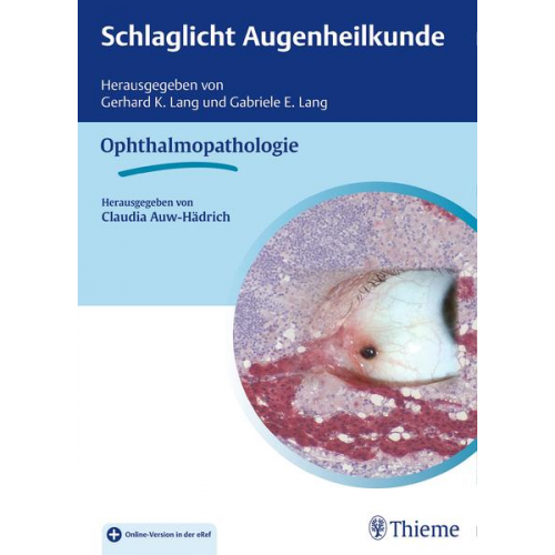 Schlaglicht Augenheilkunde: Ophthalmopathologie