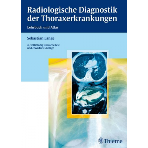 Sebastian Lange - Radiologische Diagnostik der Thoraxerkrankungen