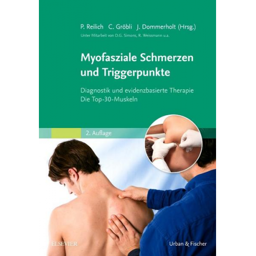 Myofasziale Schmerzen und Triggerpunkte