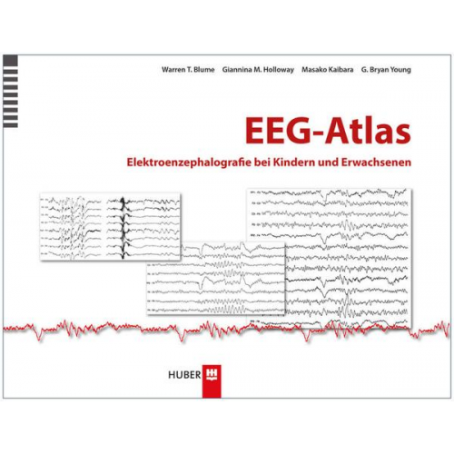 Warren T. Blume & Giannina M. Holloway & Masako Kaibara & G. Bryan Young - EEG–Atlas