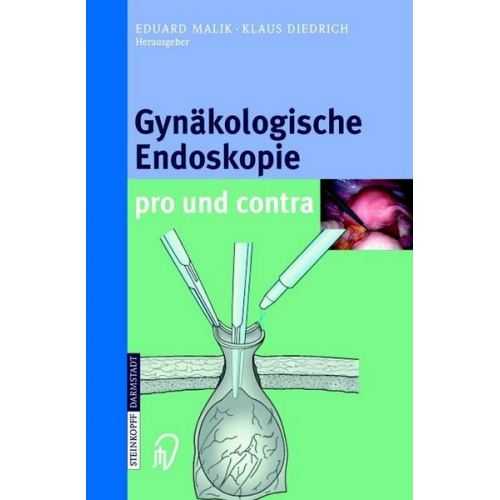 Gynäkologische Endoskopie pro und contra