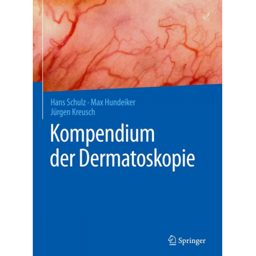 Hans Schulz & Max Hundeiker & Jürgen Kreusch - Kompendium der Dermatoskopie