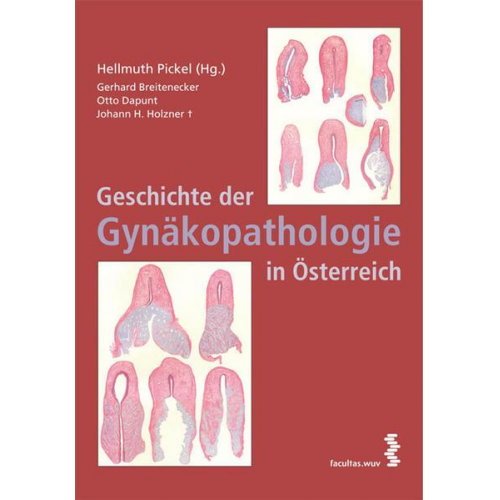 Hellmuth Pickel & Heinrich Holzner & Gerhard Breitenecker & Gregor Mikuz - Geschichte der Gynäkopathologie in Österreich