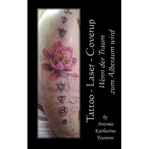 Antonia Katharina Tessnow - Tattoo - Laser - Cover Up