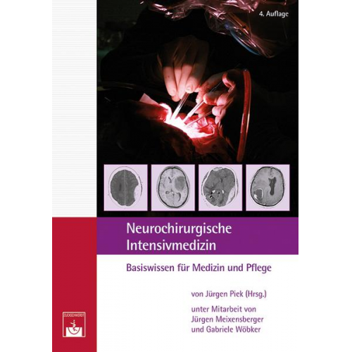 Neurochirurgische Intensivmedizin