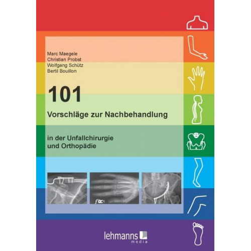 Marc Maegele & Christian Probst & Wolfgang Schütz & Bertil Bouillon - 101 Vorschläge zur Nachbehandlung