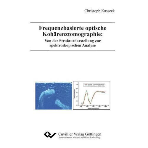 Christoph T. Kasseck - Frequenzbasierte optische Kohärenztomographie: Von der Strukturdarstellung zur spektroskopischen Analyse