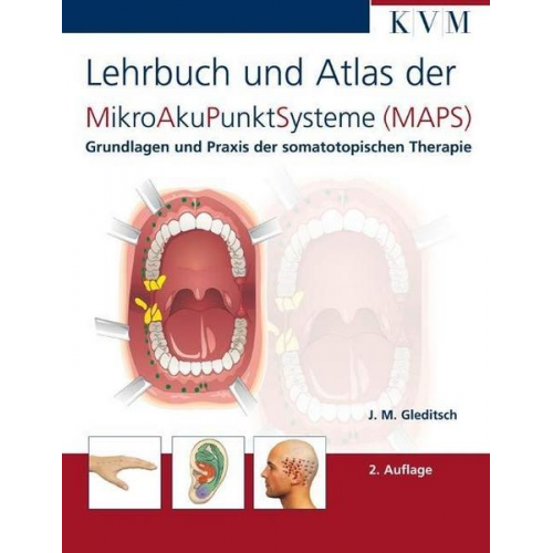 Jochen M. Gleditsch - Lehrbuch und Atlas der MikroAkuPunktSysteme (MAPS)